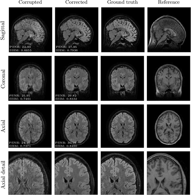 Figure 2 for Towards retrospective motion correction and reconstruction for clinical 3D brain MRI protocols with a reference contrast