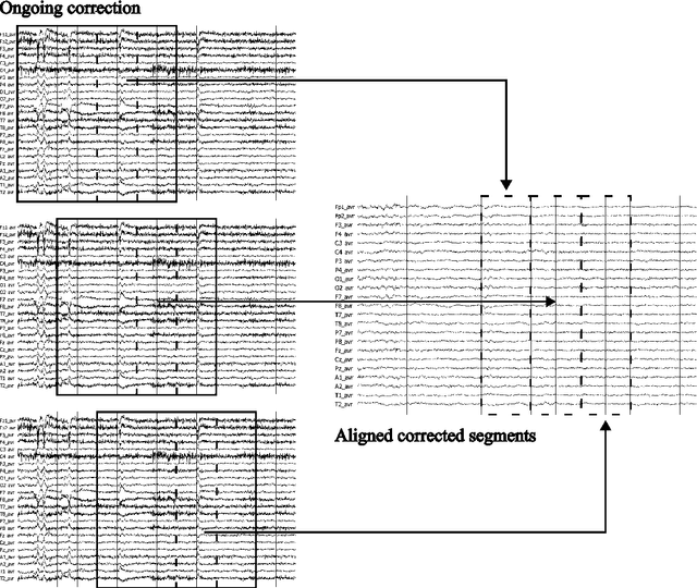 Figure 3 for Ongoing EEG artifact correction using blind source separation