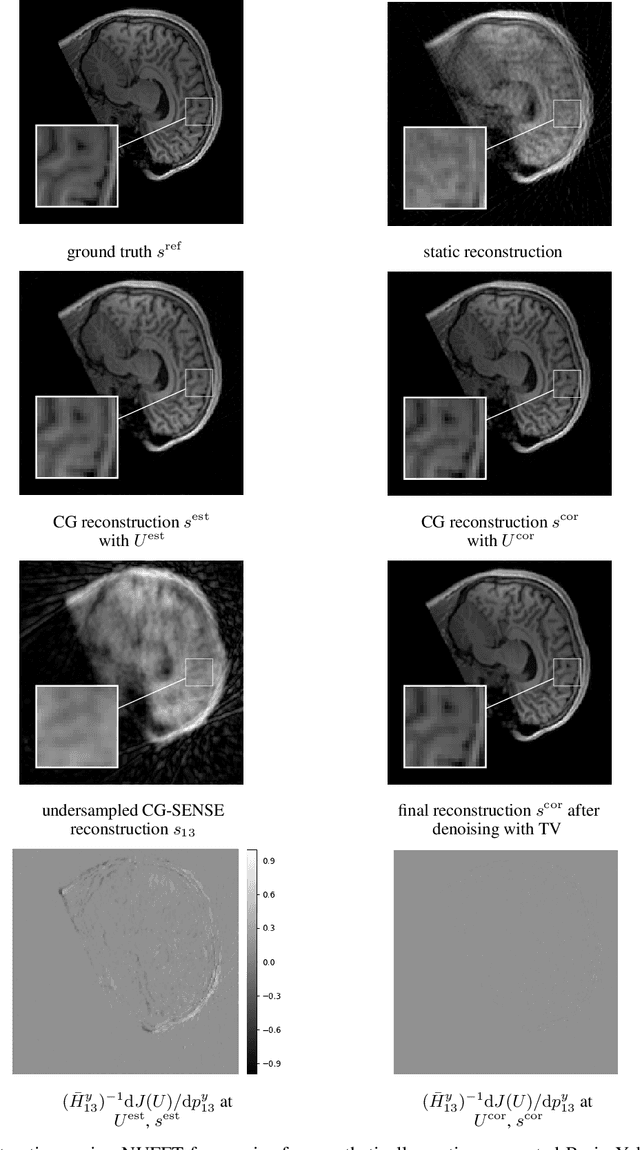 Figure 3 for Retrospective Motion Correction in Gradient Echo MRI by Explicit Motion Estimation Using Deep CNNs