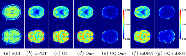 Figure 1 for Estimating Uncertainty in PET Image Reconstruction via Deep Posterior Sampling