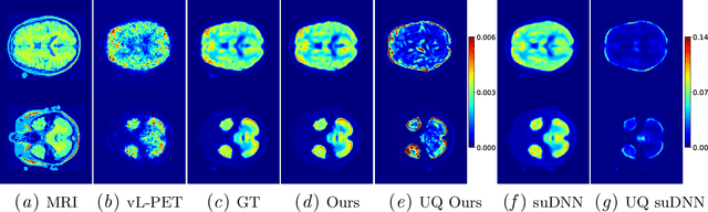 Figure 3 for Estimating Uncertainty in PET Image Reconstruction via Deep Posterior Sampling