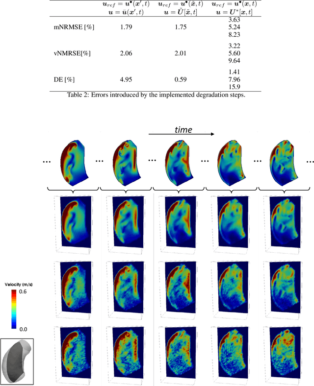 Figure 3 for Implicit neural representations for unsupervised super-resolution and denoising of 4D flow MRI