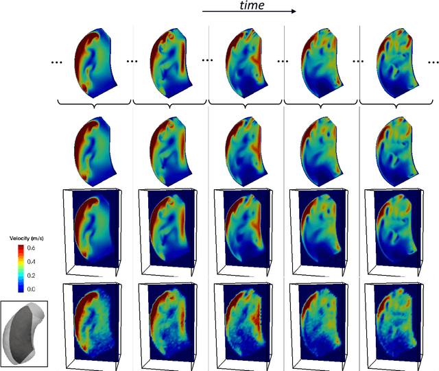 Figure 2 for Implicit neural representations for unsupervised super-resolution and denoising of 4D flow MRI