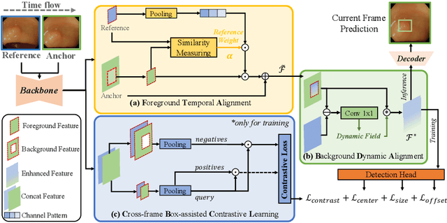 Figure 3 for YONA: You Only Need One Adjacent Reference-frame for Accurate and Fast Video Polyp Detection