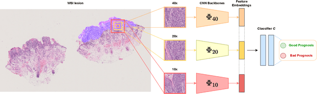 Figure 1 for Deep Learning for Predicting Metastasis on Melanoma WSIs