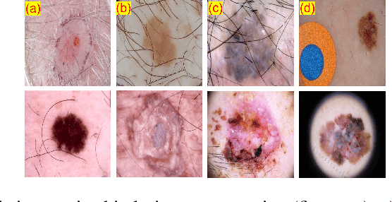 Figure 1 for Generative Adversarial Networks based Skin Lesion Segmentation