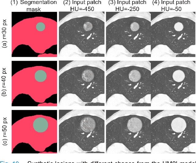 Figure 2 for Less is More: Unsupervised Mask-guided Annotated CT Image Synthesis with Minimum Manual Segmentations