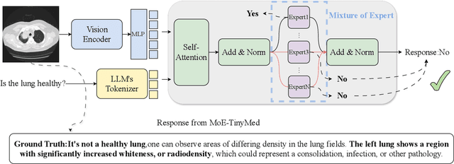 Figure 3 for MoE-TinyMed: Mixture of Experts for Tiny Medical Large Vision-Language Models