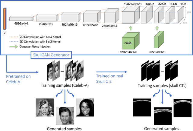 Figure 1 for SkullGAN: Synthetic Skull CT Generation with Generative Adversarial Networks