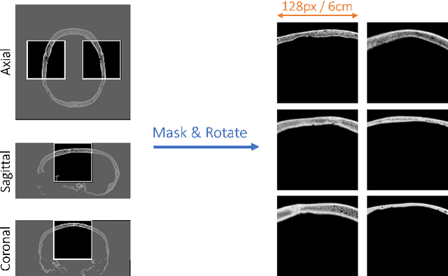 Figure 3 for SkullGAN: Synthetic Skull CT Generation with Generative Adversarial Networks