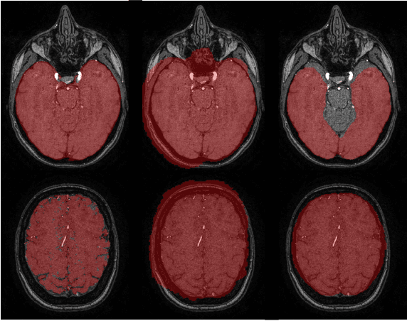 Figure 1 for JoB-VS: Joint Brain-Vessel Segmentation in TOF-MRA Images