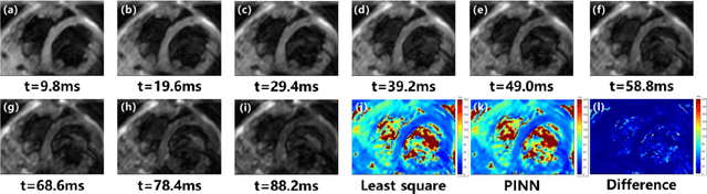 Figure 3 for Bloch Equation Enables Physics-informed Neural Network in Parametric Magnetic Resonance Imaging