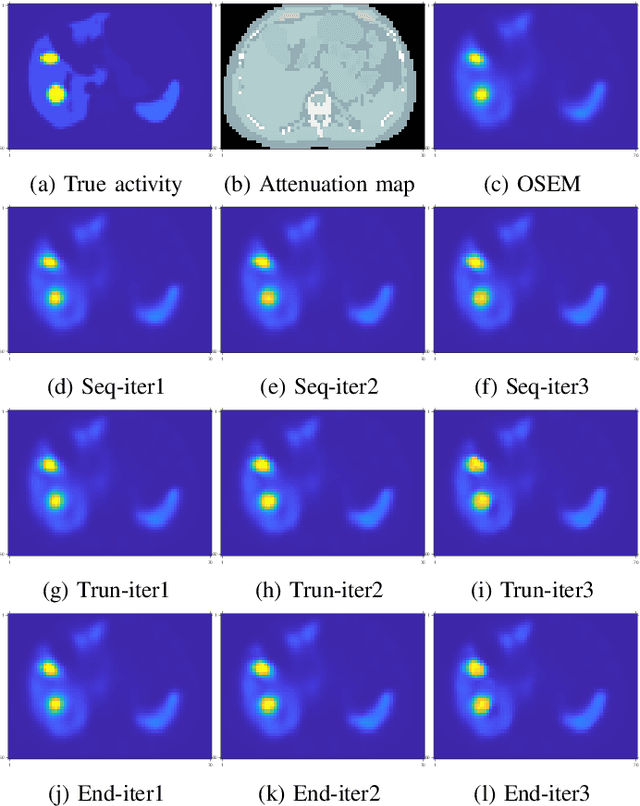 Figure 2 for Training End-to-End Unrolled Iterative Neural Networks for SPECT Image Reconstruction