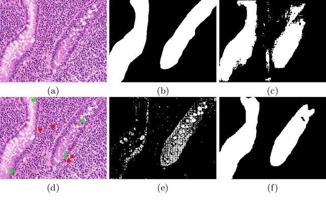 Figure 1 for AutoSAM: Adapting SAM to Medical Images by Overloading the Prompt Encoder