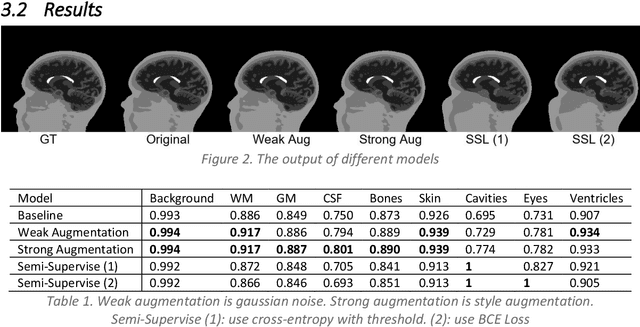 Figure 1 for Semi-supervised Learning with Robust Loss in Brain Segmentation