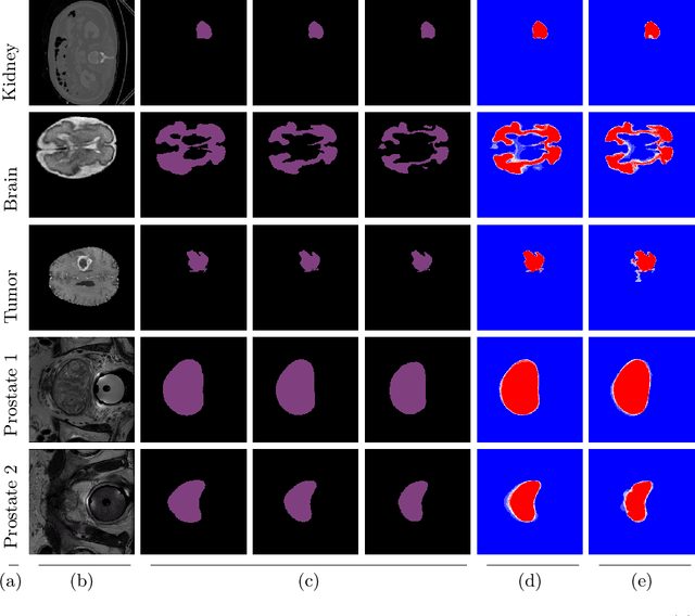 Figure 3 for Annotator Consensus Prediction for Medical Image Segmentation with Diffusion Models