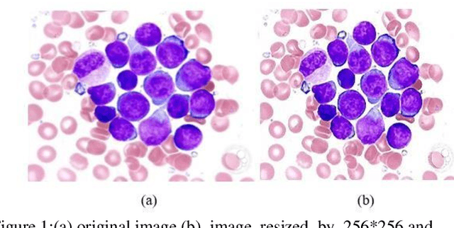 Figure 1 for Leukemia detection based on microscopic blood smear images using deep learning