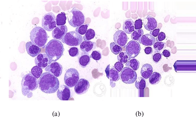 Figure 2 for Leukemia detection based on microscopic blood smear images using deep learning