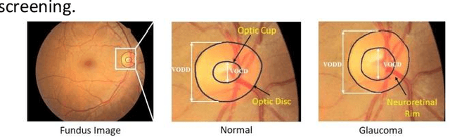 Figure 1 for UT-Net: Combining U-Net and Transformer for Joint Optic Disc and Cup Segmentation and Glaucoma Detection