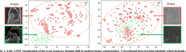 Figure 1 for BayeSeg: Bayesian Modeling for Medical Image Segmentation with Interpretable Generalizability
