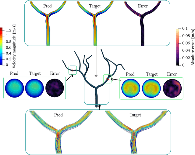 Figure 4 for Transient Hemodynamics Prediction Using an Efficient Octree-Based Deep Learning Model