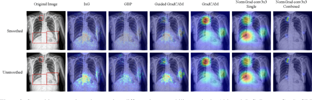 Figure 3 for Explainable Image Quality Assessment for Medical Imaging