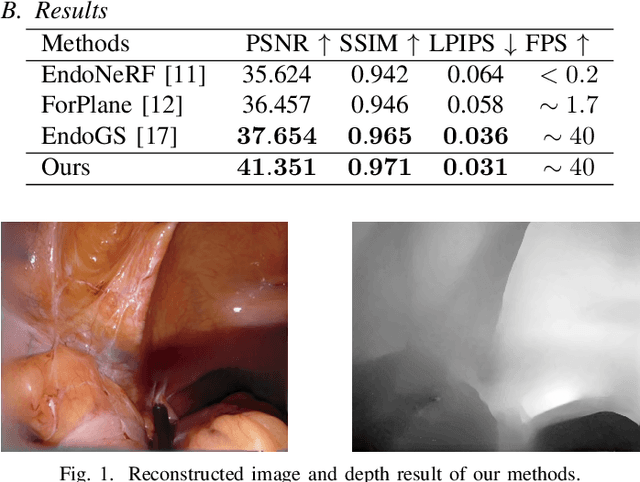 Figure 1 for EndoGaussians: Single View Dynamic Gaussian Splatting for Deformable Endoscopic Tissues Reconstruction