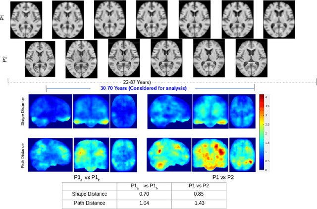 Figure 4 for A metric to compare the anatomy variation between image time series