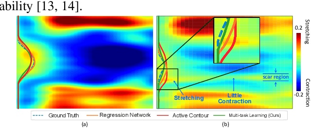 Figure 2 for Multitask Learning for Improved Late Mechanical Activation Detection of Heart from Cine DENSE MRI