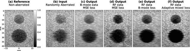 Figure 3 for Phase Aberration Correction without Reference Data: An Adaptive Mixed Loss Deep Learning Approach