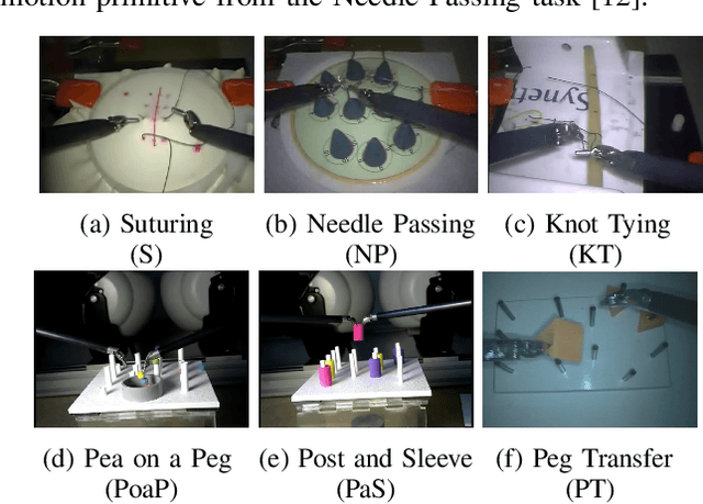 Figure 3 for Evaluating the Task Generalization of Temporal Convolutional Networks for Surgical Gesture and Motion Recognition using Kinematic Data