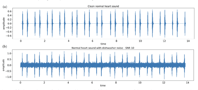 Figure 2 for Exploring the Impact of Noise and Degradations on Heart Sound Classification Models
