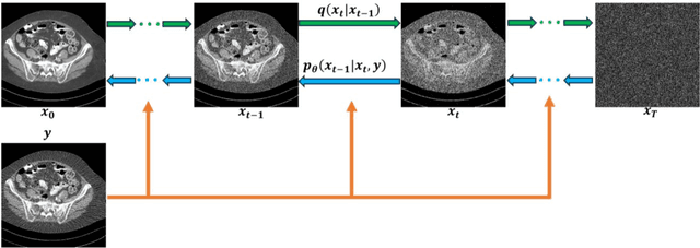 Figure 1 for Blind CT Image Quality Assessment Using DDPM-derived Content and Transformer-based Evaluator