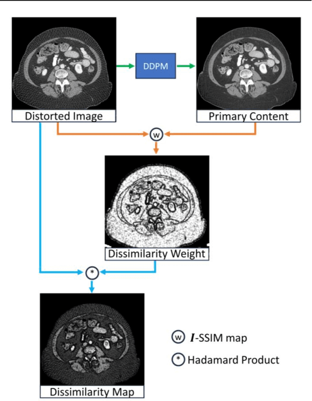 Figure 2 for Blind CT Image Quality Assessment Using DDPM-derived Content and Transformer-based Evaluator