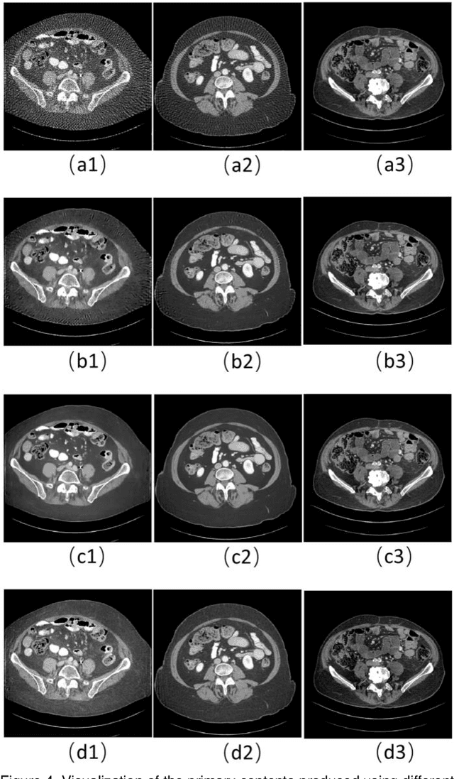 Figure 4 for Blind CT Image Quality Assessment Using DDPM-derived Content and Transformer-based Evaluator