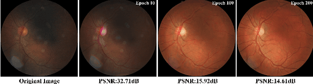 Figure 3 for Optimal Transport Guided Unsupervised Learning for Enhancing low-quality Retinal Images