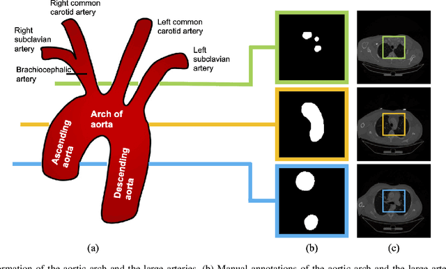 Figure 1 for Topology-Aware Loss for Aorta and Great Vessel Segmentation in Computed Tomography Images