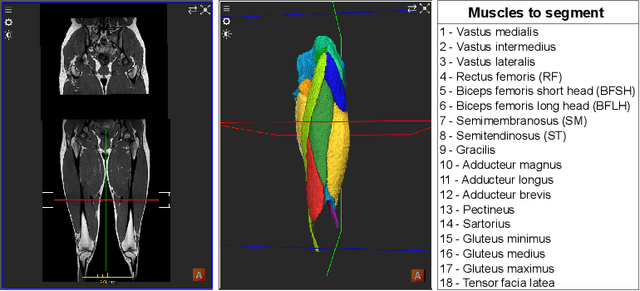 Figure 1 for Muscle volume quantification: guiding transformers with anatomical priors