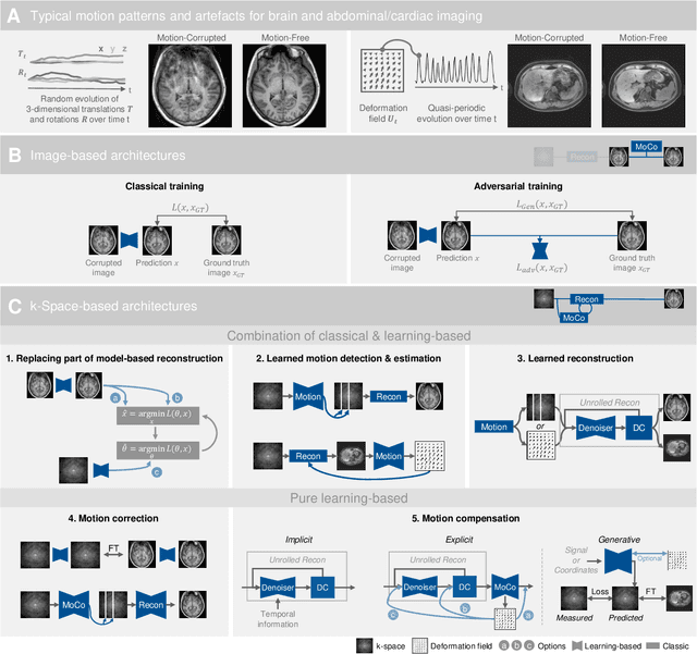 Figure 1 for Deep Learning for Retrospective Motion Correction in MRI: A Comprehensive Review