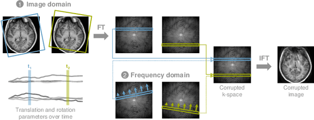 Figure 2 for Deep Learning for Retrospective Motion Correction in MRI: A Comprehensive Review
