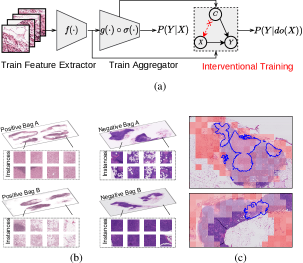Figure 1 for Interventional Bag Multi-Instance Learning On Whole-Slide Pathological Images