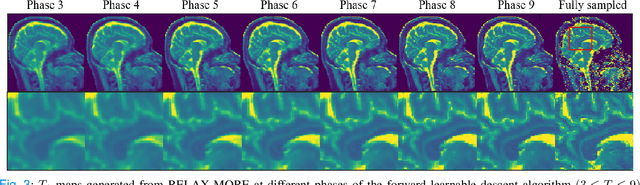 Figure 3 for Magnetic Resonance Parameter Mapping using Self-supervised Deep Learning with Model Reinforcement