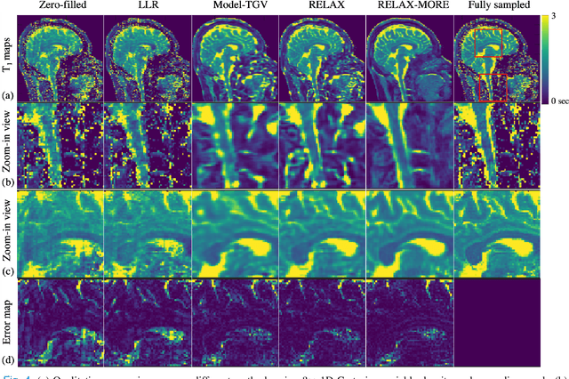Figure 4 for Magnetic Resonance Parameter Mapping using Self-supervised Deep Learning with Model Reinforcement