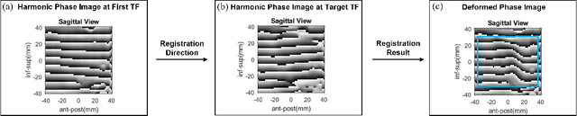 Figure 1 for New starting point registration method for tagged MRI tongue motion estimation