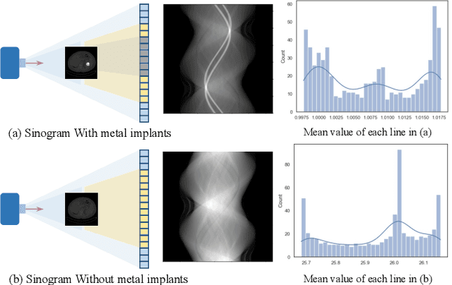 Figure 1 for RetinexFlow for CT metal artifact reduction