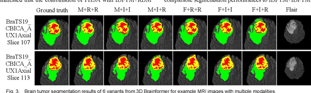 Figure 3 for 3D Brainformer: 3D Fusion Transformer for Brain Tumor Segmentation