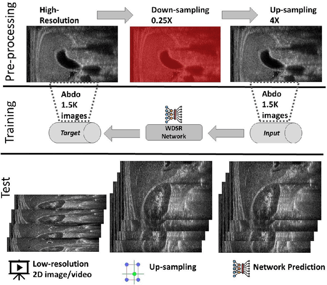 Figure 2 for Learning-based Framework for US Signals Super-resolution