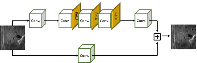 Figure 4 for Learning-based Framework for US Signals Super-resolution