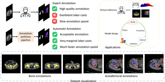 Figure 1 for A Dataset for Deep Learning-based Bone Structure Analyses in Total Hip Arthroplasty