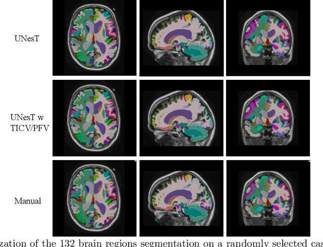 Figure 4 for Enhancing Hierarchical Transformers for Whole Brain Segmentation with Intracranial Measurements Integration